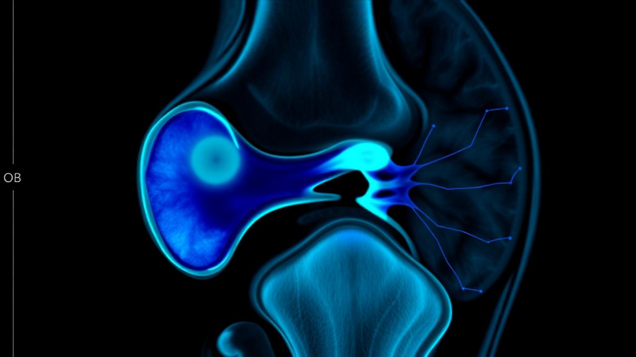 Musculoesquelético — visualización IA